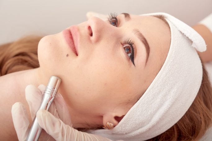 Microneedling for dull looking skin Micro-injections for facial rejuvenation. Aesthetics Clinic Camberley. Anti-wrinkle