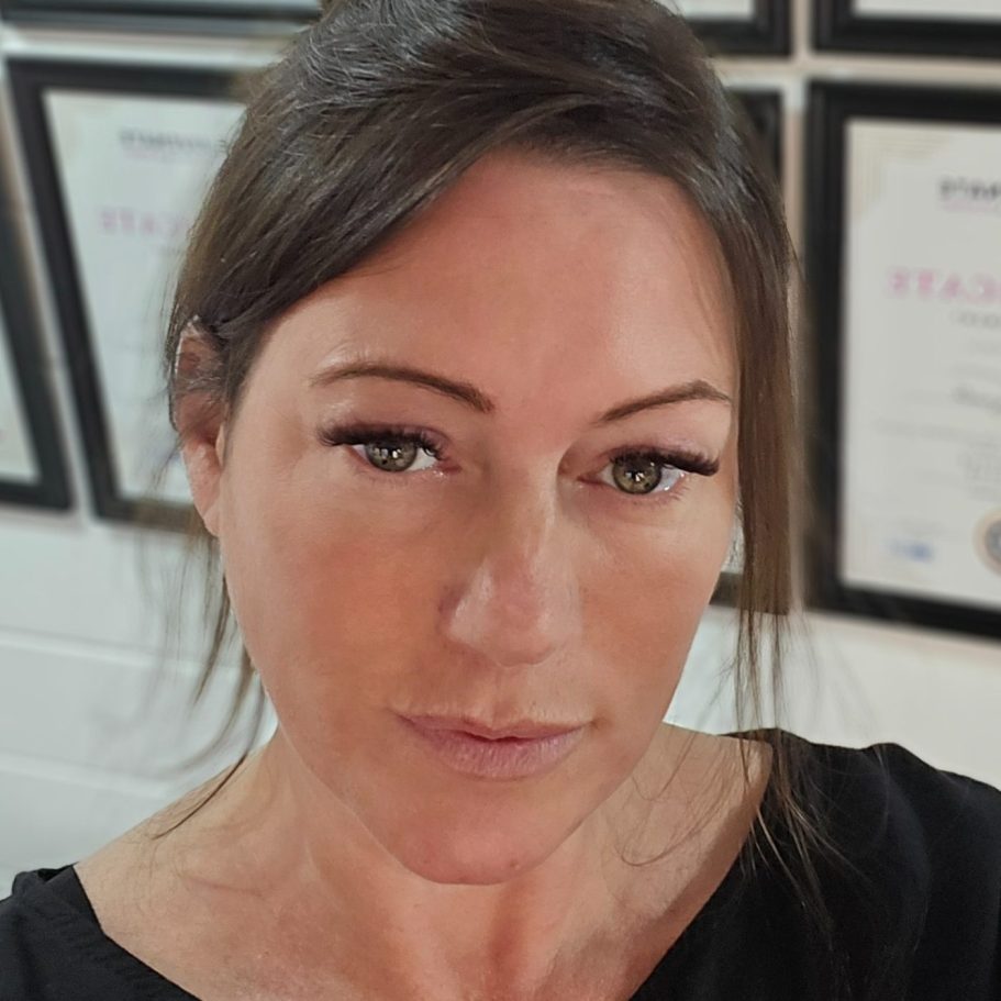 Bex is the Owner at BX Aesthetics Camberley Introducing Bex. Owner of BX Aesthetics Frimley, Camberley. Bex is professional, personable and most of all an ethical practitioner.